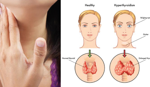 Endocrinology & Metabolism